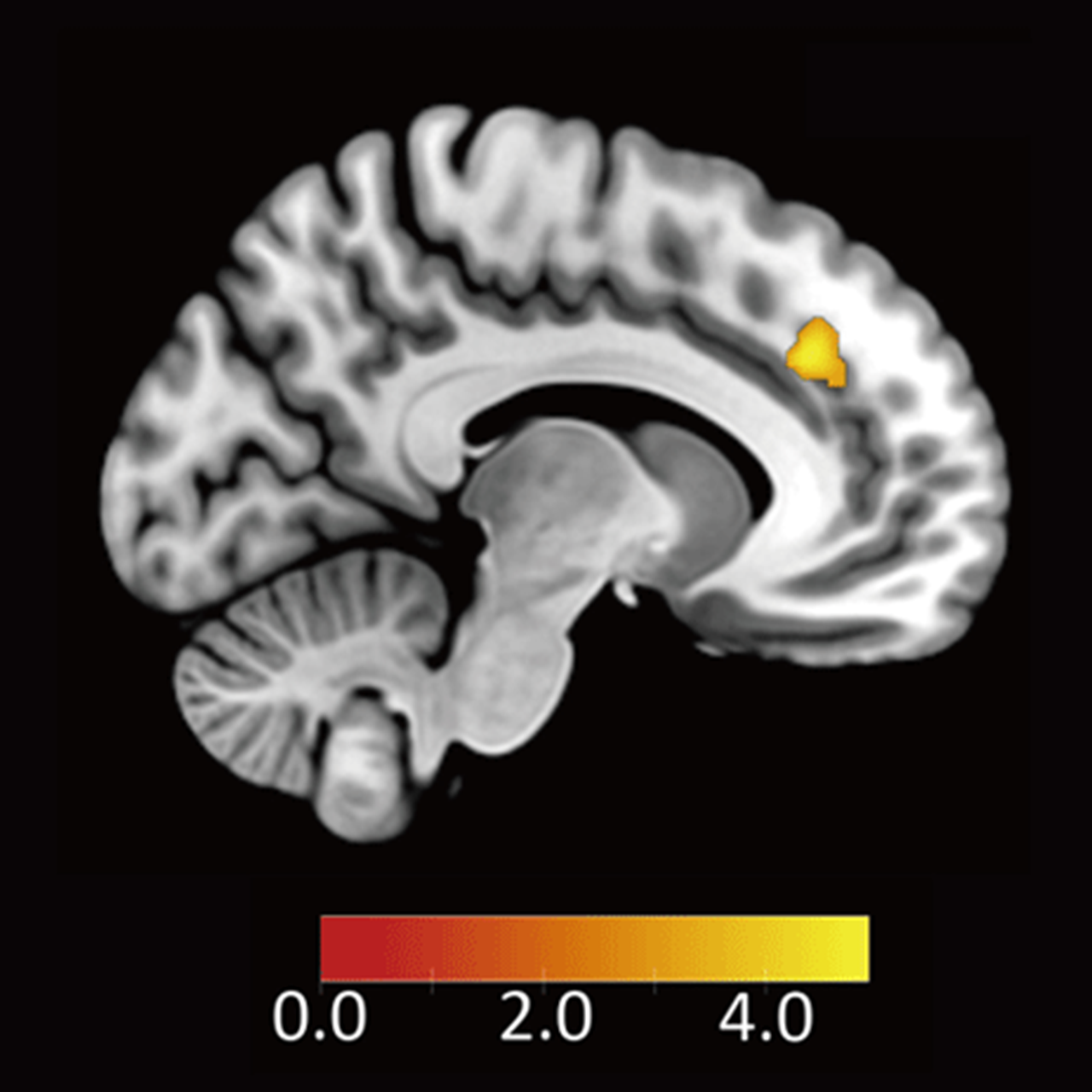 不公平な提案を受け入れる参加者ほど不公平に対して反応する脳領域(背側前帯状皮質)画像