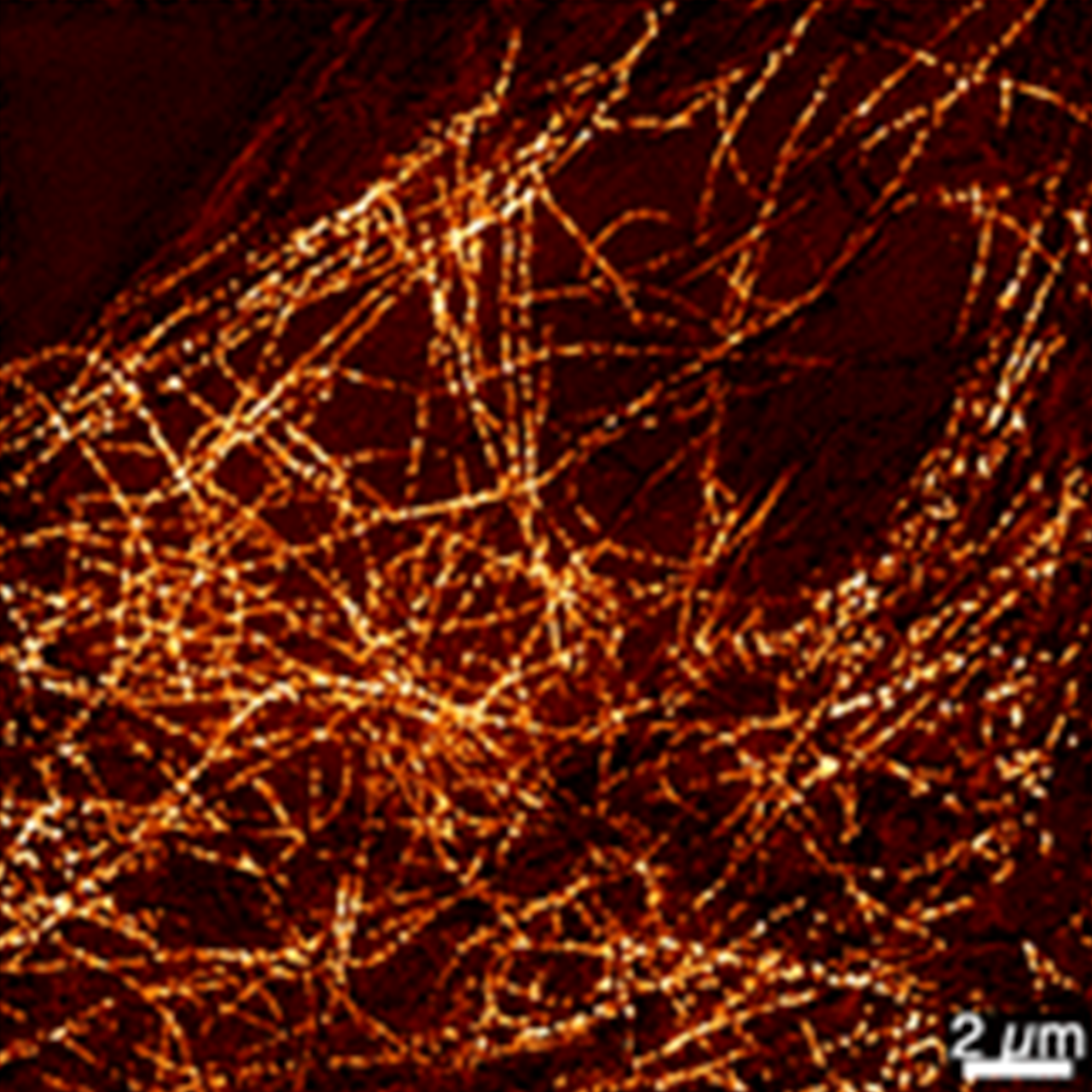 ファイカオで補正した細胞骨格の繊維の超解像顕微鏡画像
