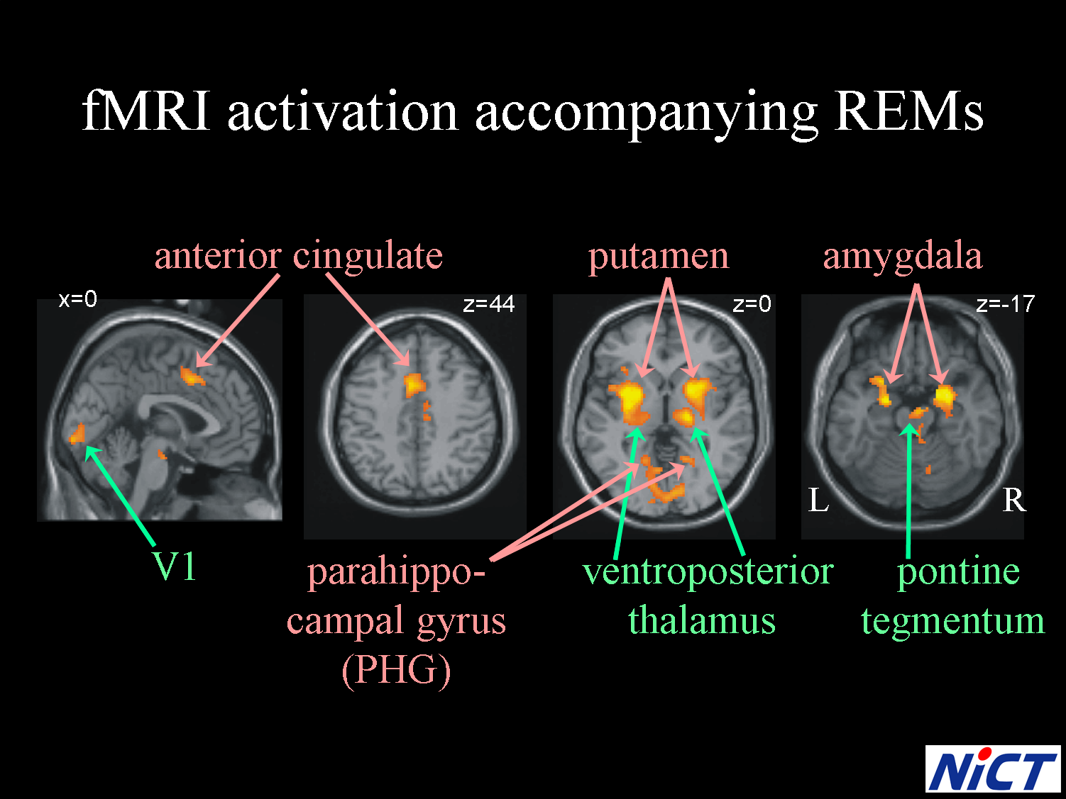in rem sleep brain