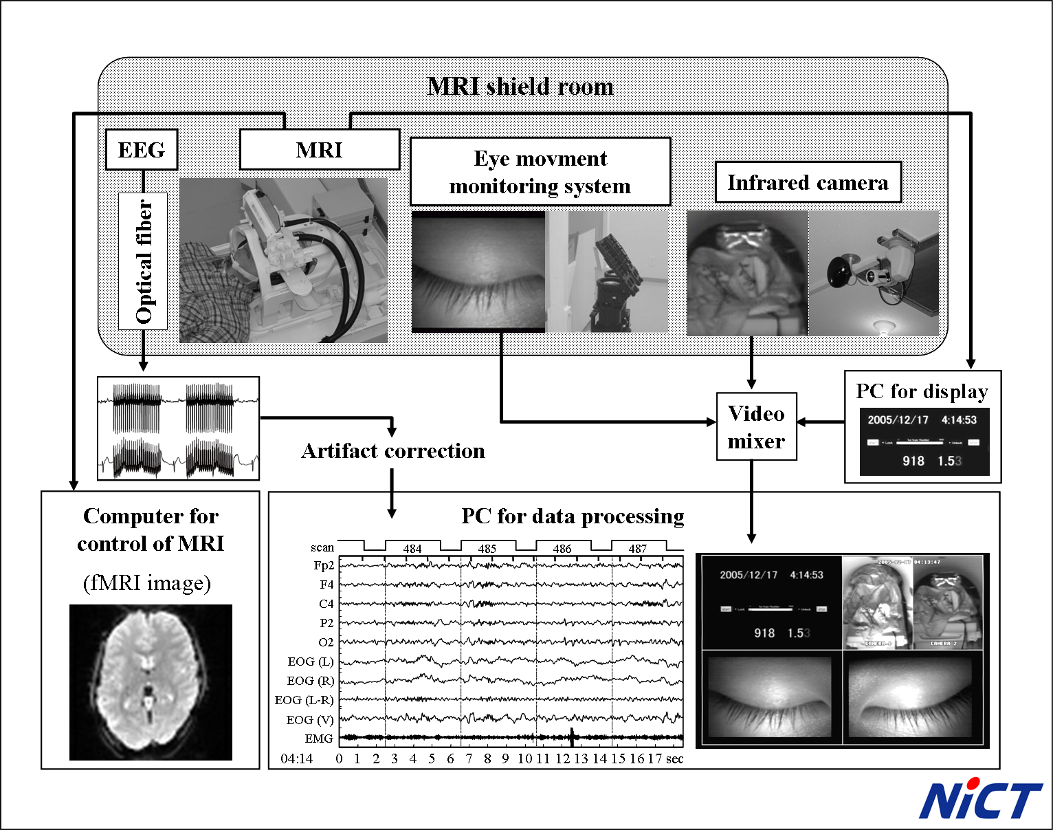 Schematic diagram of our simultaneous EEG/fMRI recording system