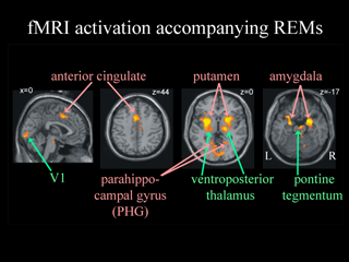 Brain Activation accompanying REMs during REM sleep