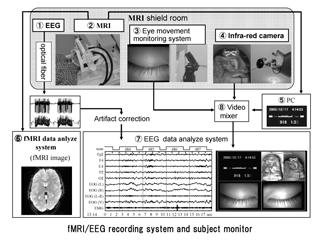 simultaneous EEG-fMRI recording system