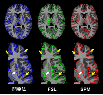 MP2RAGE segmentation