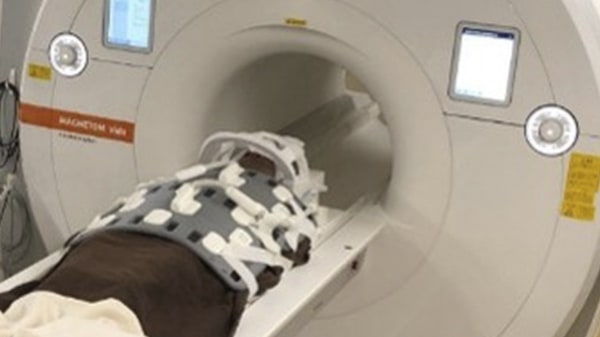 3T MRI